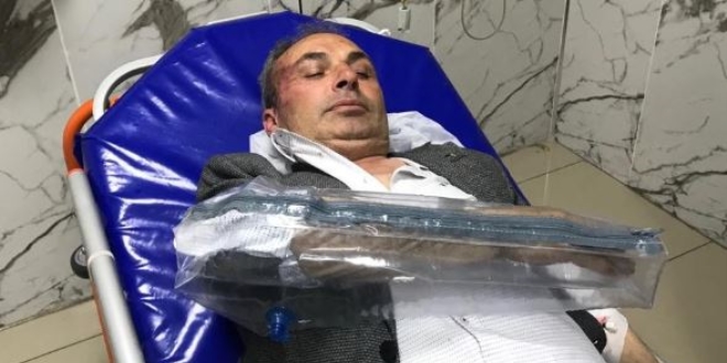 CHP'li Belediye Başkan Yardımcısına saldırı