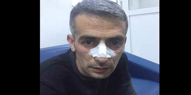 Komutandan, aya 'mant neden pimedi' daya