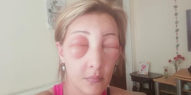 Kuaföre giden kadın canından oluyordu