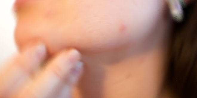 Uzmanlardan uyarlar: 'Ay dede' hastalna dikkat!