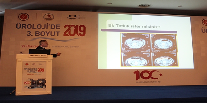 Konferansta, böbrek taşı ameliyatı canlı gösterildi