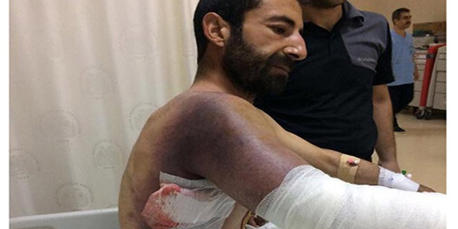 Yaraladığı yılan geri dönüp soktu... Durumu kritik