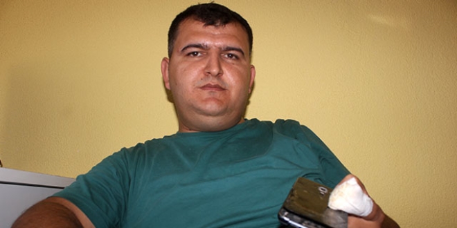 Cebindeki telefon patladı, sürücü yaralandı