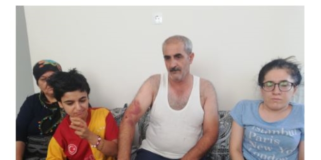 Engelli kız ve babasına 'Bana niye oy vermedin' dayağı