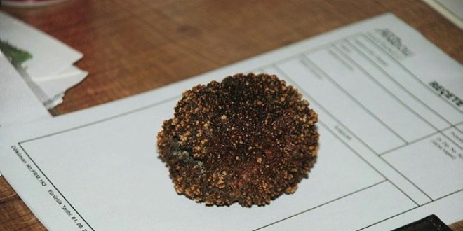 Mesanesinde 220 gramlık tek parça taş çıktı