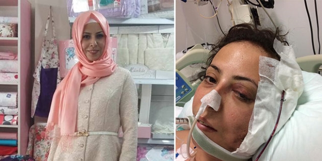 K�z�n�n g�z� �n�nde vurulmu�tu! Ac� haber geldi