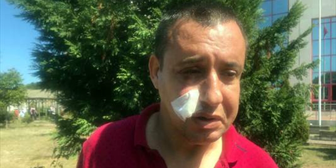 Yeni asfalt yola girdi diye gaziyi darp ettiler