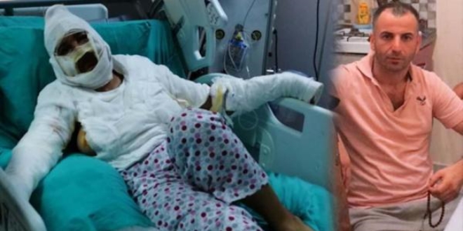 İzinle çıkan tutuklu, bıçakladığı kadına kızgın yağ döktü