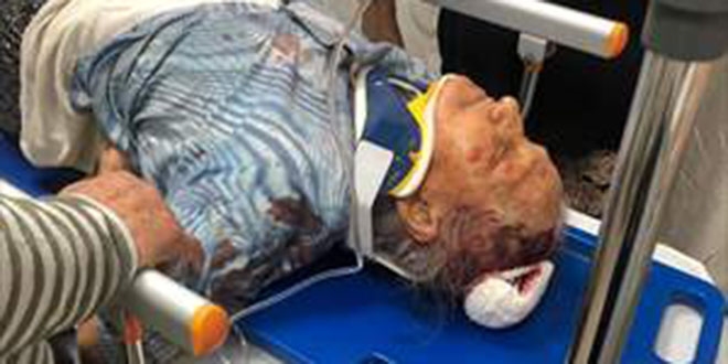 92 ya��ndaki kad�n� bilezi�i i�in gasp ettiler