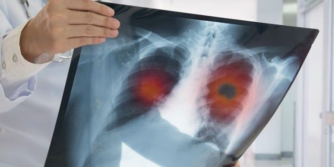 Elektronik sigara ile ilgili iddialar doğrulandı