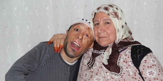 Mehmet Ali'ye müjdeli haber! Bakanlık destek verecek