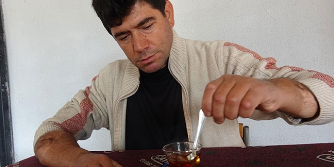 Tıp tarihine geçmişti... Nakil kollarıyla yaşama tutunuyor