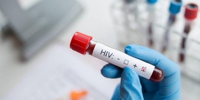 'Son 6 yılda AIDS vakaları 5 kat arttı'