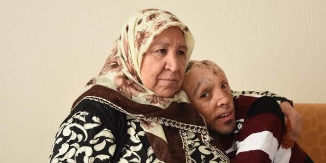 Mehmet Ali'yi ameliyat edecek doktorlar aranıyor