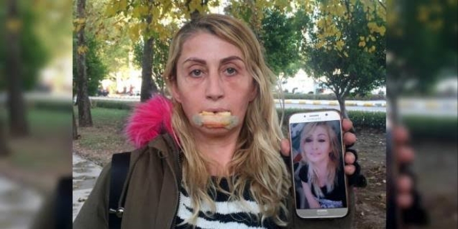 Güzellik uğruna hayatı karardı
