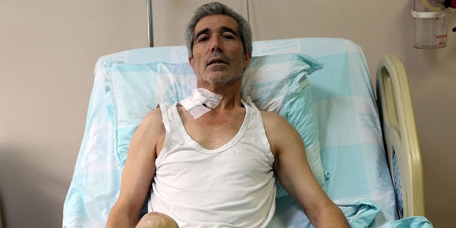Ayağı doku nakliyle kesilmekten kurtarıldı