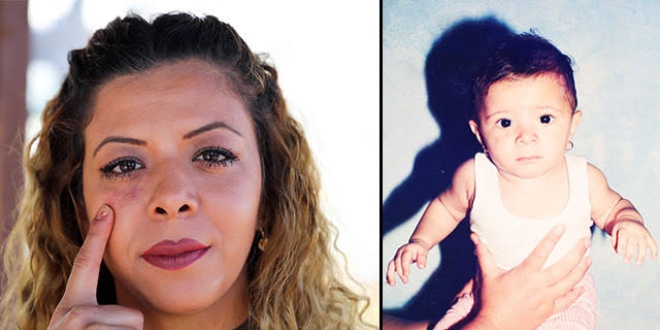 Do�um lekesi umut oldu, ger�e�in pe�ine d��t�