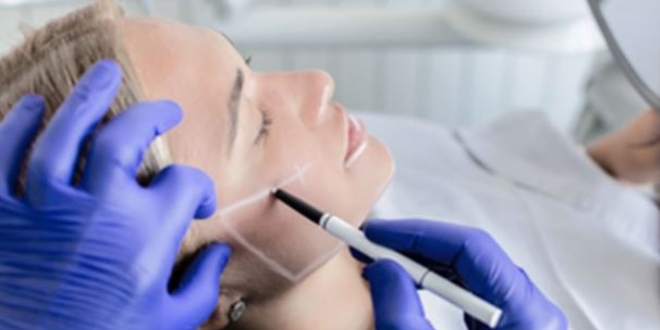 Merdiven altı estetik yüz anatomisini bozabilir