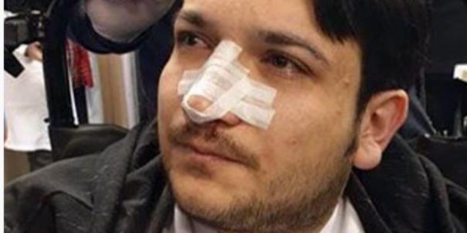 Randevusuz muayene olmak istedi, doktorun burnunu kırdı