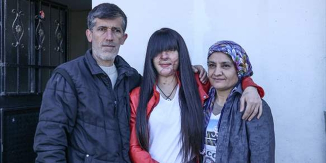 Asitli saldırı mağduru Berfin ve ailesinden Erdoğan'a teşekkür
