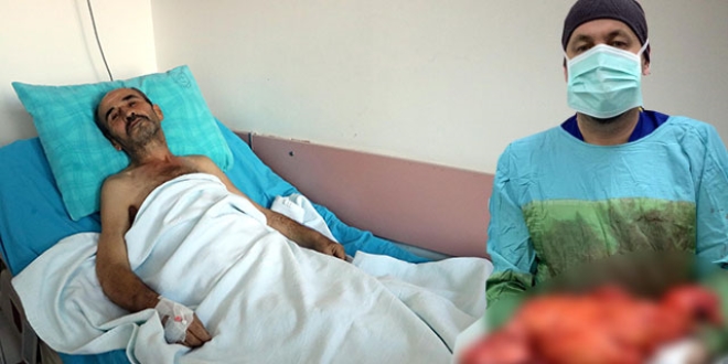 Karın ağrısıyla gitti, karnından 11 kiloluk kitle çıkarıldı