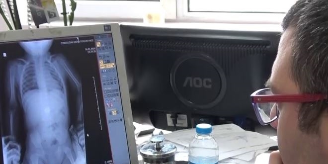 Oyun oynarken para yuttuğu röntgende tespit edildi
