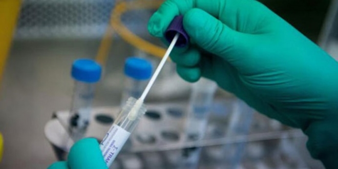 Virüsü tespit eden test geliştirildi