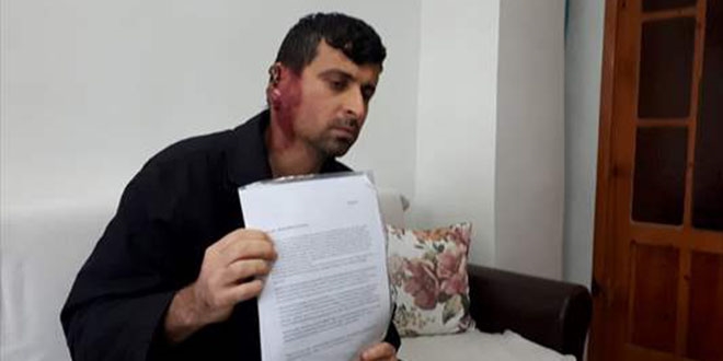 Kulağını saran tümörden kurtulmak için yardım bekliyor