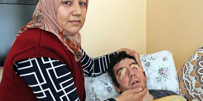 Bu acının tarifi yok... 6 yıldır gözlerini kırpamıyor