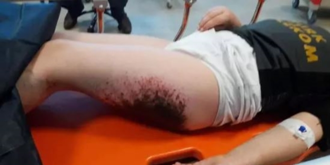 Kartopu oynarken felaketi yaşamıştı... Berat okula gidemiyor!
