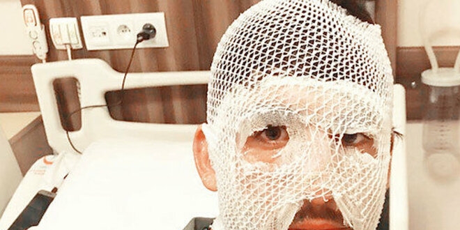 Yunan polisi mültecinin üzerine kaynar su döktü