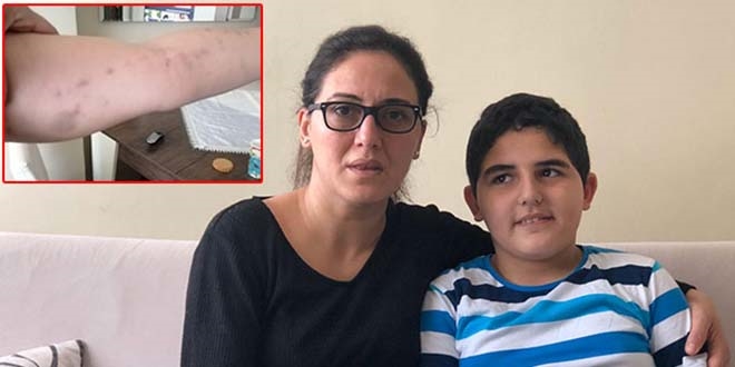 Anneden 'Otizmli �ocu�um okulda d�v�ld�' iddias�