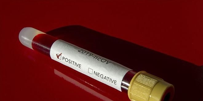 Kovid-19 bula�an ki�i say�s� 135 bine yakla�t�