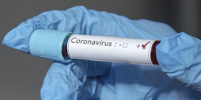 Koronavirüsün dünya ekonomisine maliyeti 347 milyar doları bulabilir