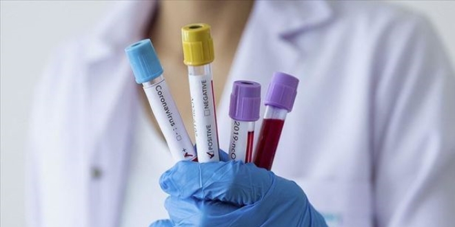 Fransa'da koronavirüs nedeniyle bir doktor hayatını kaybetti