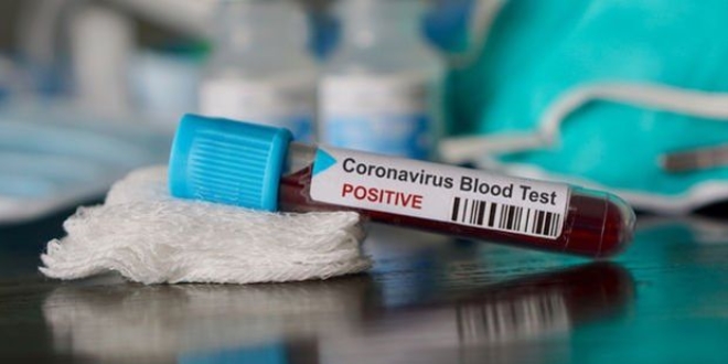 Dünya genelinde koronavirüs görülen kişi sayısı 600 bini aştı