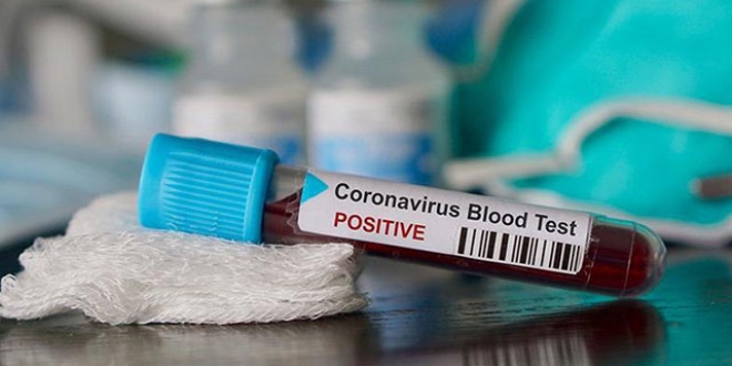 İspanya'da 12 bin sağlık çalışanı koronavirüse yakalandı