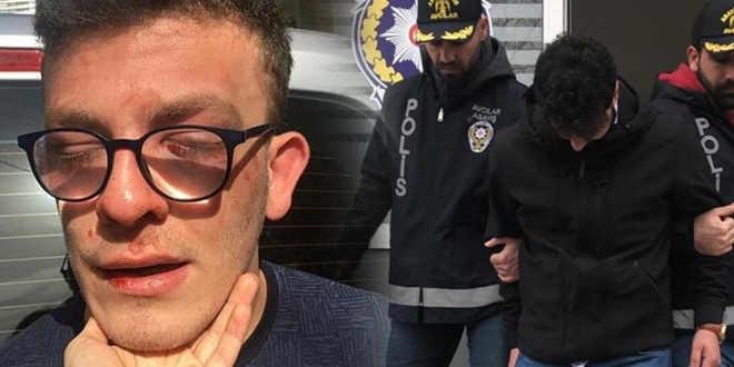 Adli Tıp otizmli gence 'kendisini savunabilir' dedi, şüpheli tahliye edildi