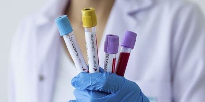 İBB'nin 90 personelinin koronavirüs testi pozitif çıktı