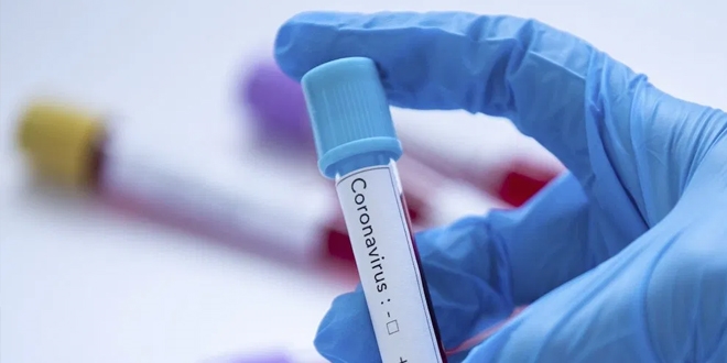 Trabzon'da koronavirs tedavisi gren 21 kii taburcu edildi