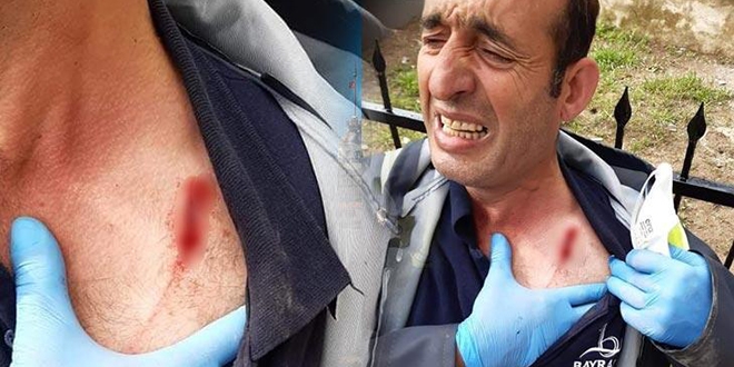 Belediye çalışanı dezenfekte çalışmaları sırasında saldırıya uğradı