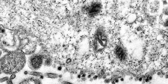 Koronavirsn hcreye saldr an bilim insanlarnca grntlendi