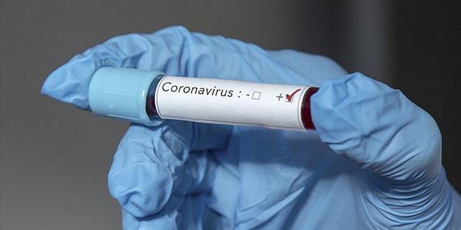 Nobel dll Fransz doktor, koronavirsn in'de laboratuvarda retildiini iddia etti
