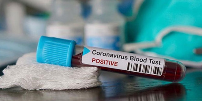ABD aratrd: Gne  koronavirs ldrebiliyor mu?