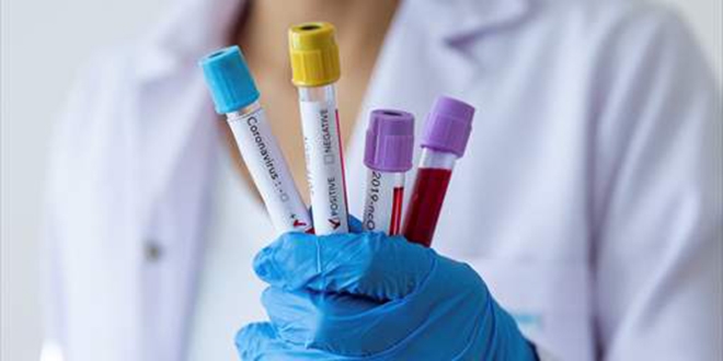 Karab�k'te koronavir�sten �lenlerin say�s� 7'ye y�kseldi