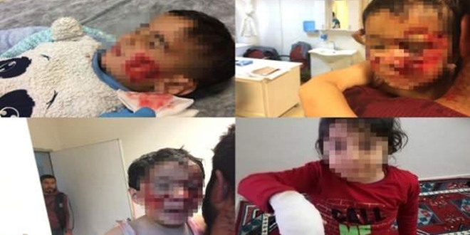 Köpek saldırısına uğrayan 6 çocuktan biri kurtarılamadı
