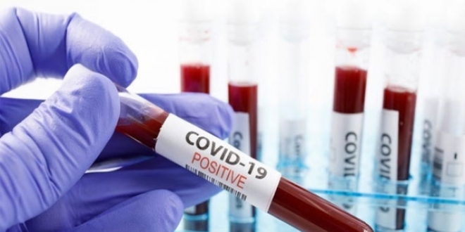 Kayseri'de iki sigara datcsnda koronavirs tespit edildi