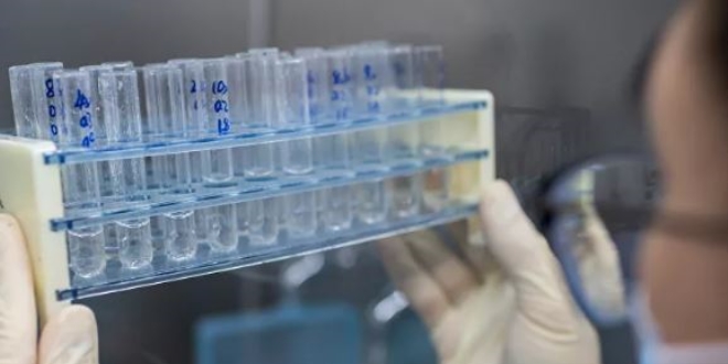 Dakikalar i�inde sonu� veren ilk koronavir�s testine onay