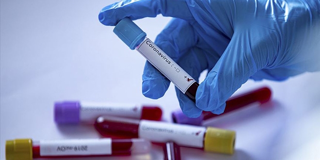 Hastaneden kaçan koronavirüs şüphelisini doktor yakaladı