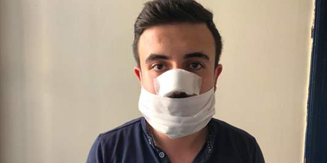 Sıra yüzünden sağlık çalışanını darp ettiler